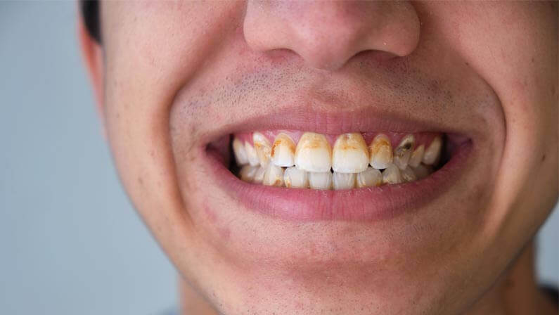 DIY tooth powder for strong teeth, homemade toothpowder to remove plaque